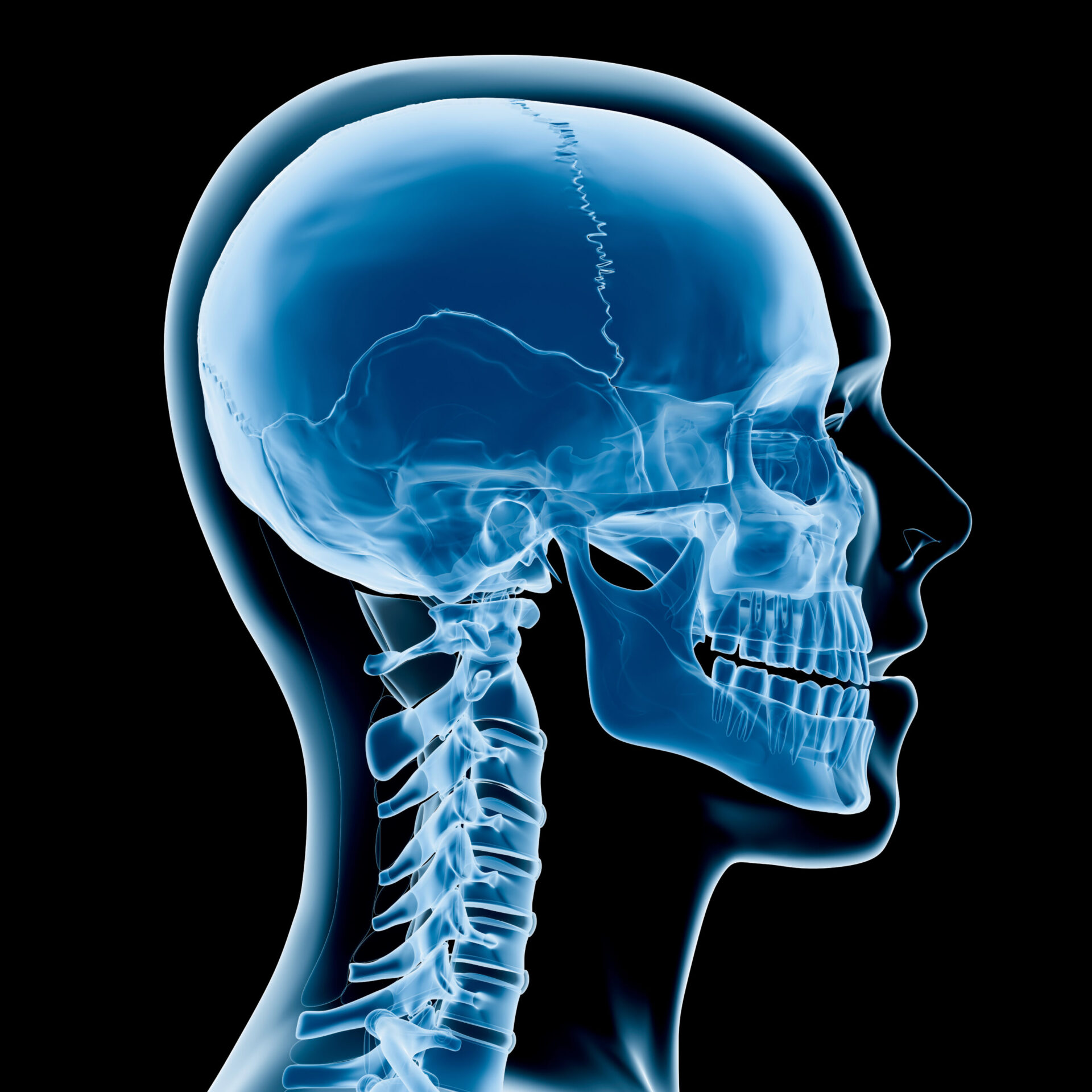 Digital medical illustration: Lateral (side) x-ray view (orthogonal) of human skull and neck. Featuring: