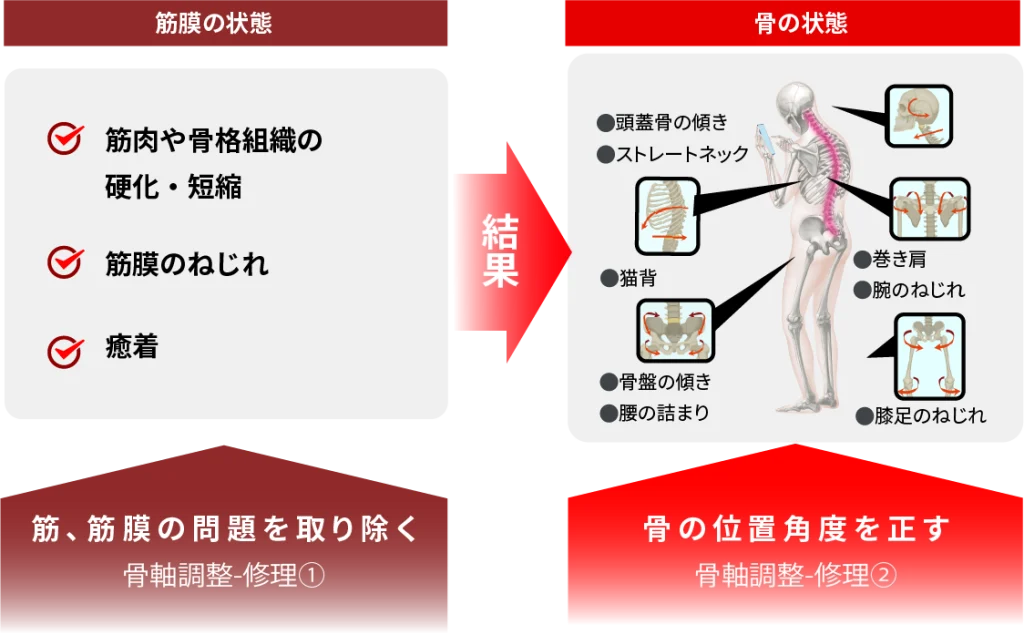 骨軸調整ー修理の解説図