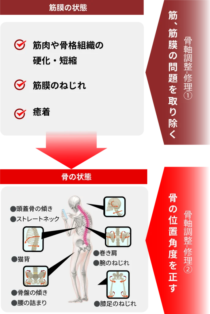骨軸調整ー修理の解説図