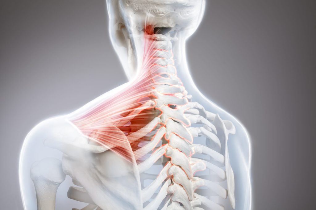 Neck pain, cervical vertebrae spine, human body anatomy Shoulder and trapezius pain. Man view from back, back arm pain